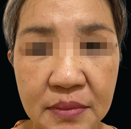 Before/After Image
